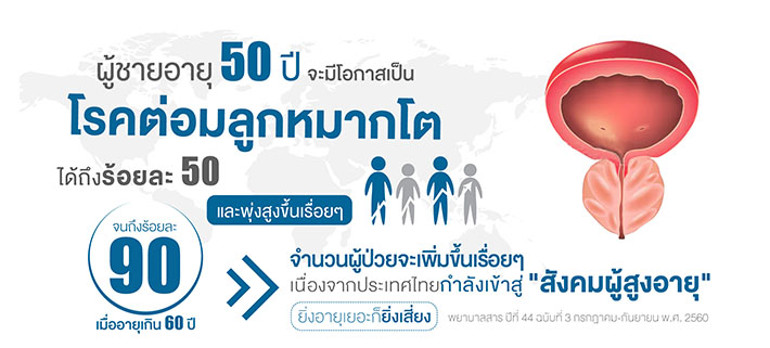 ผู้ชายอายุ 50 ปี จะมีโอกาสเป็นโรค ต่อมลูกหมากโต