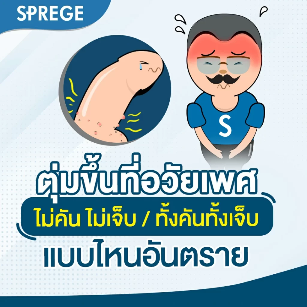 มีตุ่มขึ้นที่อวัยเพศชาย ไม่คันไม่เจ็บ