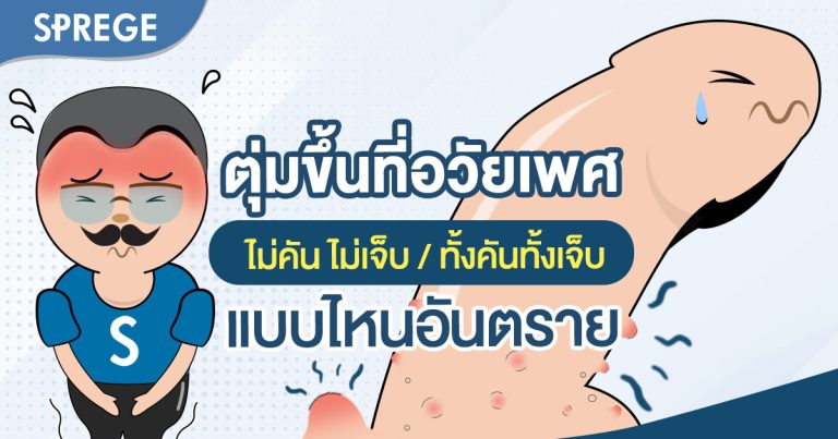 มีตุ่มขึ้นที่อวัยวะเพศชาย ไม่คันไม่เจ็บ คืออะไร รักษายังไงได้บ้าง