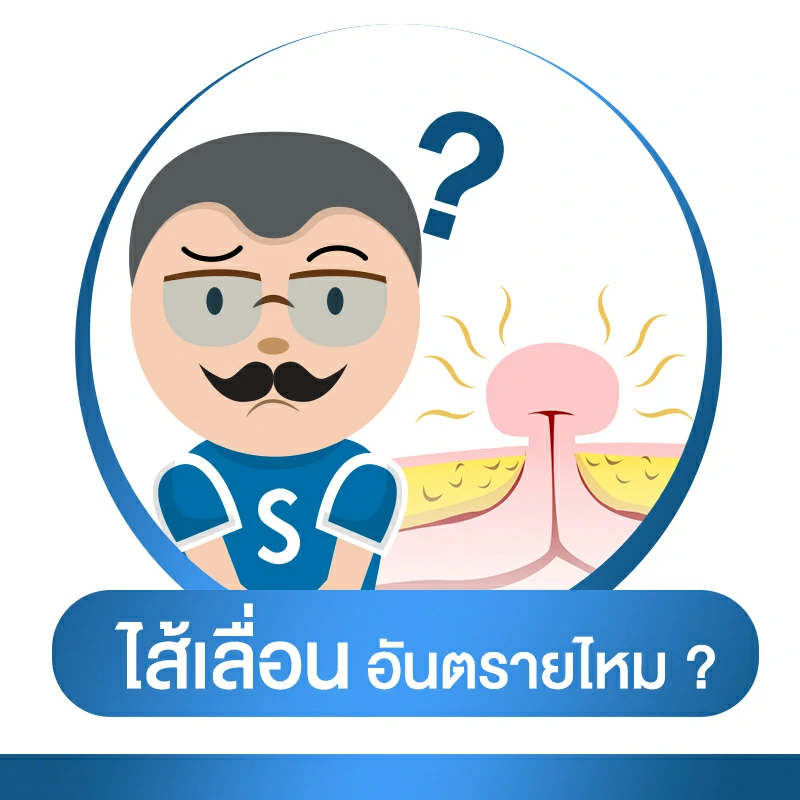 โรคไส้เลื่อน อันตรายไหม