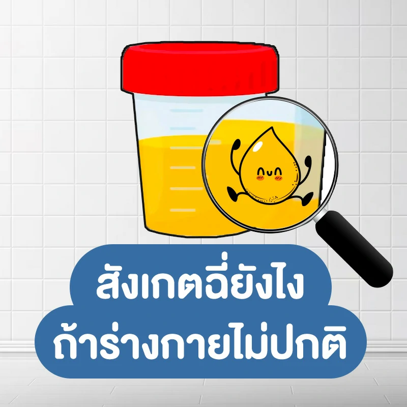 5 วิธีสังเกตฉี่ยังไง ถ้าร่างกายไม่ปกติ